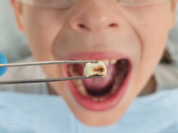Best After-Hours Emergency Dentist in Grandview Plaza, KS